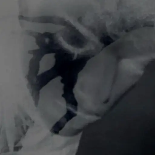 Single cover: eyewater